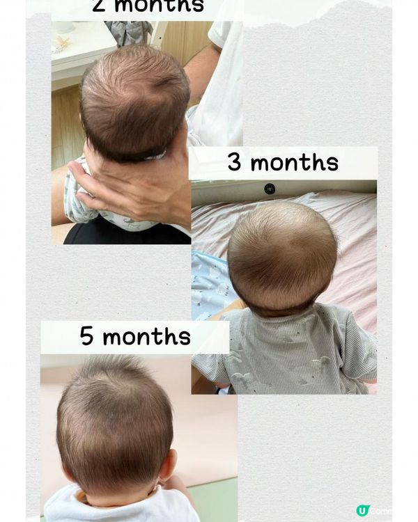 #預防嬰兒扁頭好物分享 👶🏻《babymoov Lovenest 枕頭》  #有圖分享前後對比