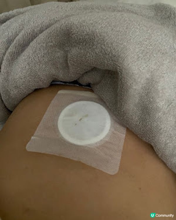 沈香灸療廷展青春，由暖宮做起~ 中醫婦科聖手Beauty Lab 女性婦科診所