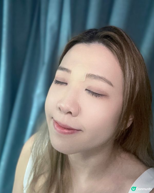 皺眉頭變皺紋😭去紋貼救我！