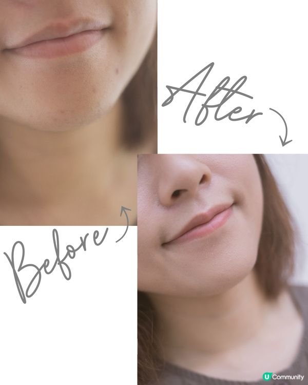 𝐁𝐲𝐞 𝐁𝐲𝐞石頭瘡👋🏻