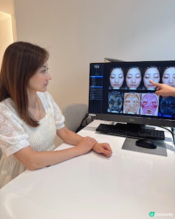 夏天瘋狂出斑？！超有效去斑：enLIGHTen 皮秒激光去斑 $333,$999/3次