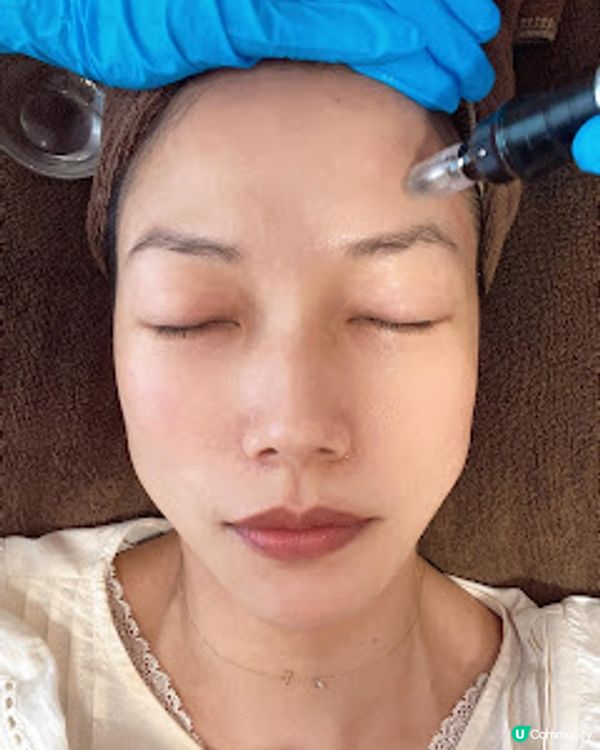 Queen’s Beauty & Spa 逆時針療程 無需針劑注射 強效抗衰老 面部輪廓即時提升