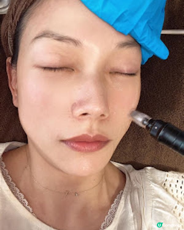 Queen’s Beauty & Spa 逆時針療程 無需針劑注射 強效抗衰老 面部輪廓即時提升