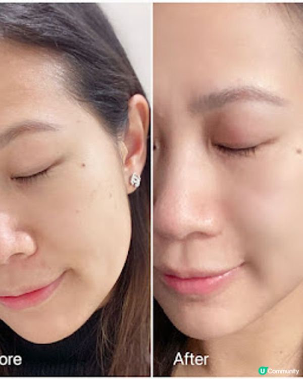 ★我心目中皇牌中的皇牌 - Lancôme Génifique小黑瓶★