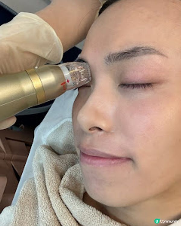 香港都有得做SylfirmX 矽谷電波啦！｜Glowin' beaute