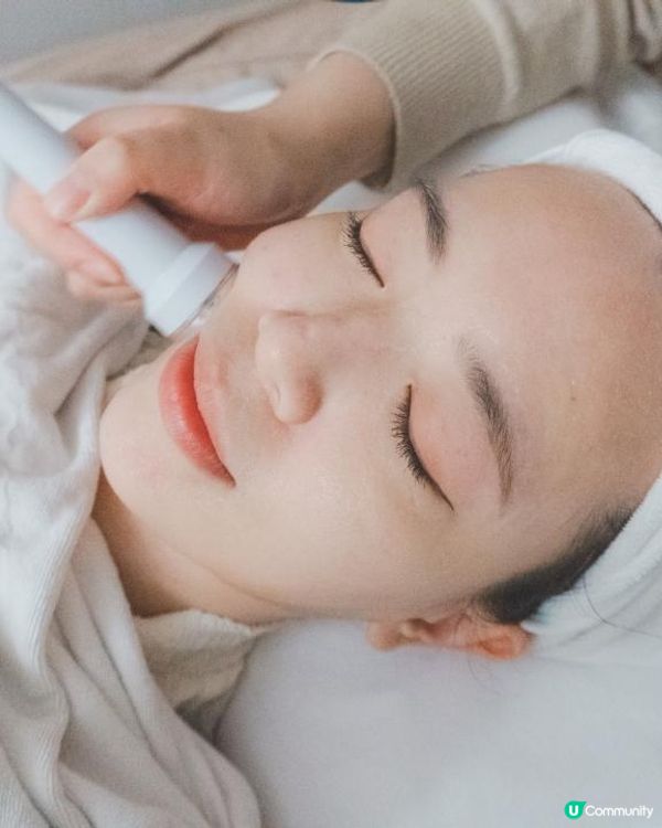 公開血淚抗痘之路！喺Alyssa搵到解決原生痘肌的方法