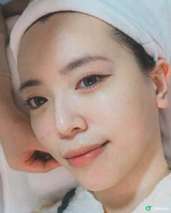 公開血淚抗痘之路！喺Alyssa搵到解決原生痘肌的方法