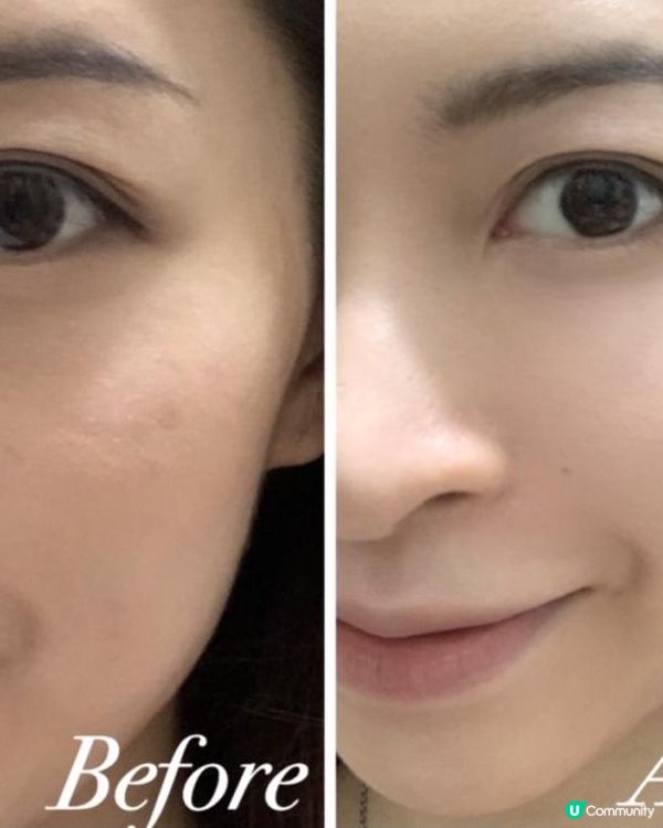 🍑Unimat Skin Repair Smoothies 