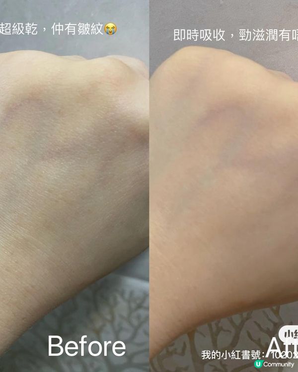 唯一不會產生油脂粒的精華油