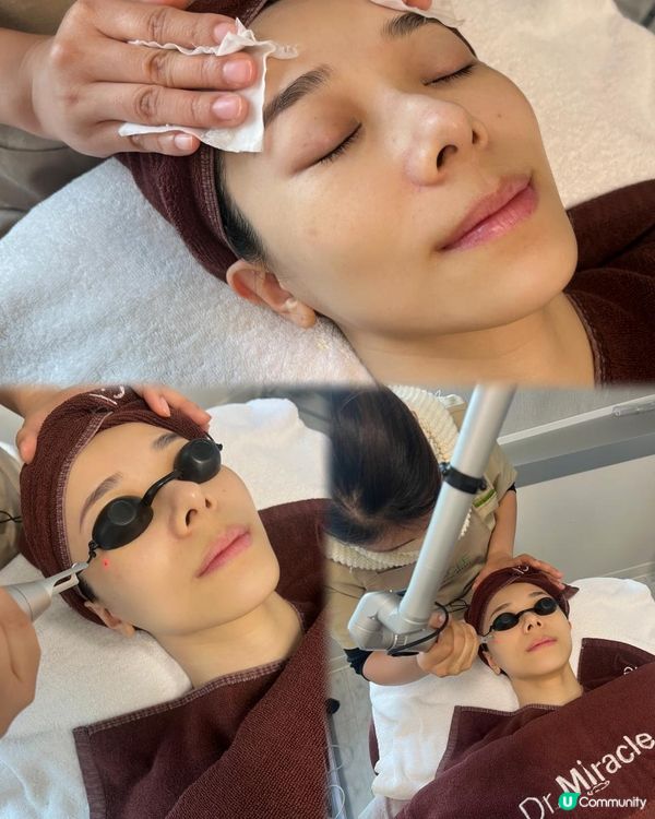 【美容實測】效果滿意！｛Dr. Miracle 皮秒激光去斑療程｝保持年輕一小步💕
