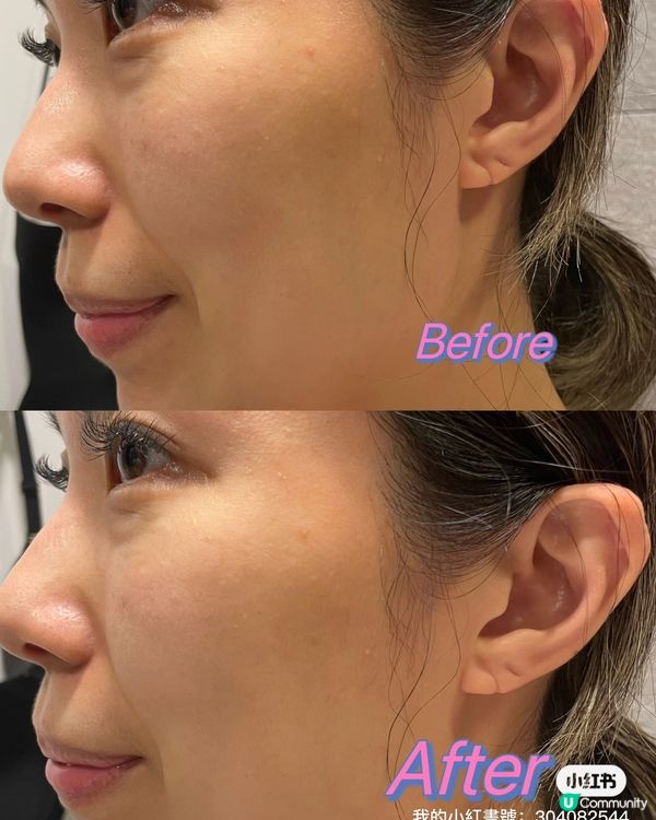 告別黑頭粉刺暗粒！✨ 木瓜酵素洗顏粉+去角質啫喱，皮膚白滑零