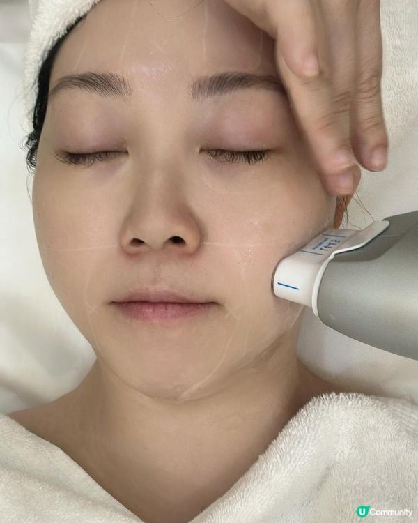 美容院打Hifu療程，輪廓提升