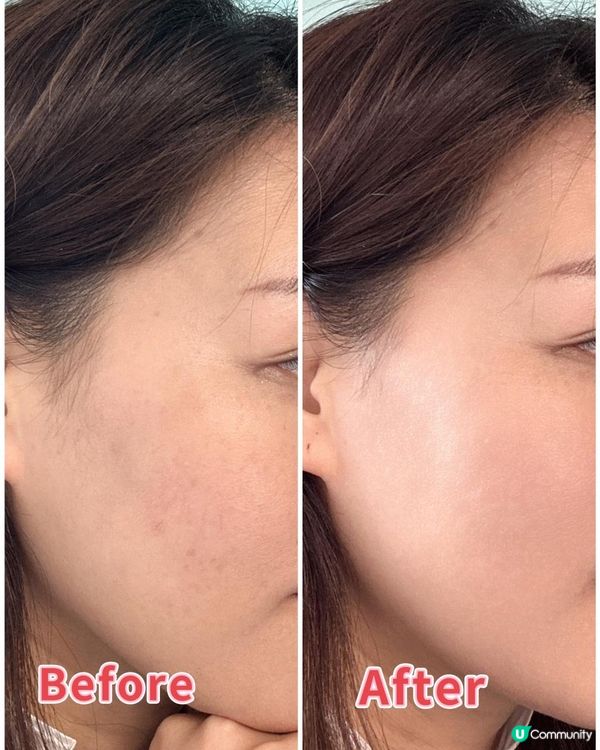 【#捉緊淨白時機】