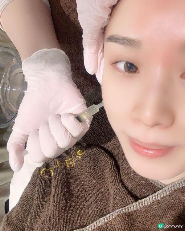 Queen’s beauty and spa🌸TCA 換膚Treatment