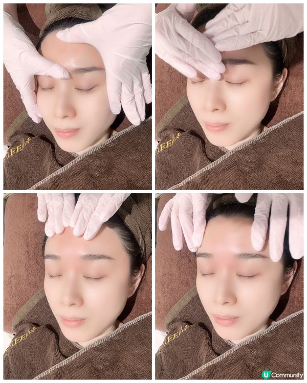 Queen’s beauty and spa🌸TCA 換膚Treatment