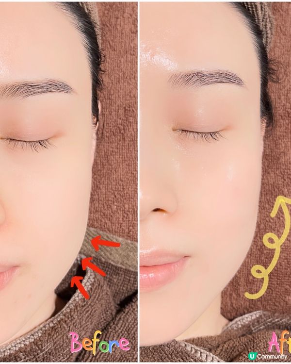 Queen’s beauty and spa🌸TCA 換膚Treatment