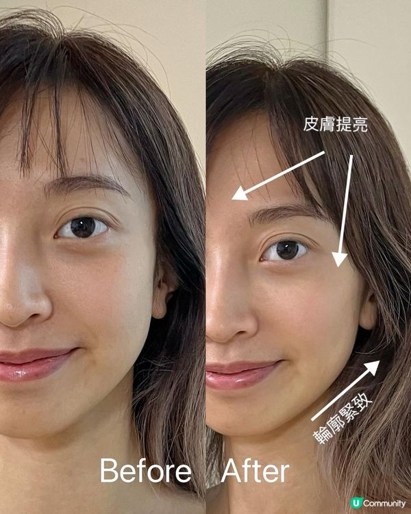 🎉 6大皺紋、7天見效！🎉