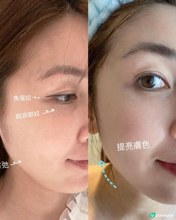 最近照鏡見到臉上開始出現皺紋