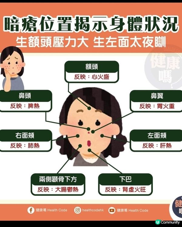 暗瘡生面部位