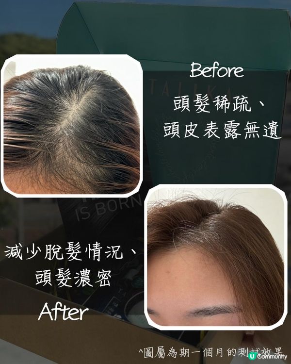 #兩個月育髮效果超好