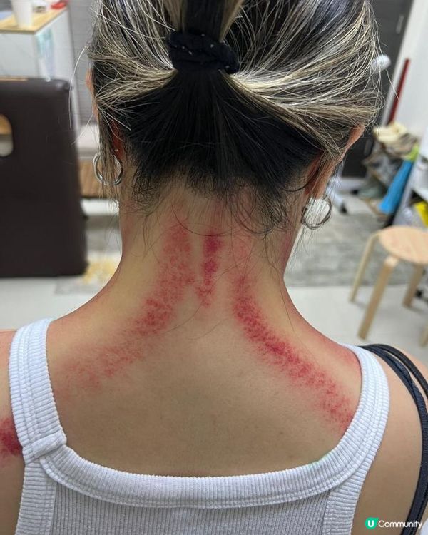 頸梗膊痛？觀塘痛症治療中心幫到你！💪🏻🤕