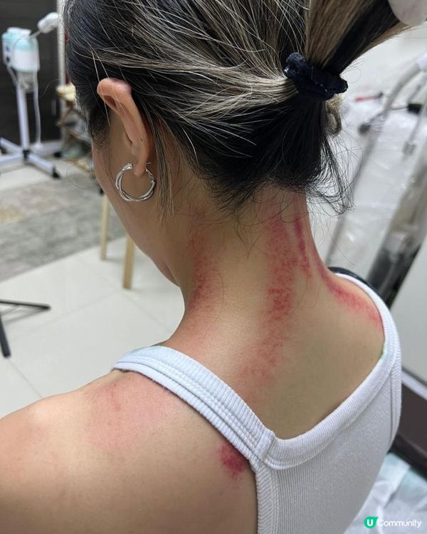 頸梗膊痛？觀塘痛症治療中心幫到你！💪🏻🤕