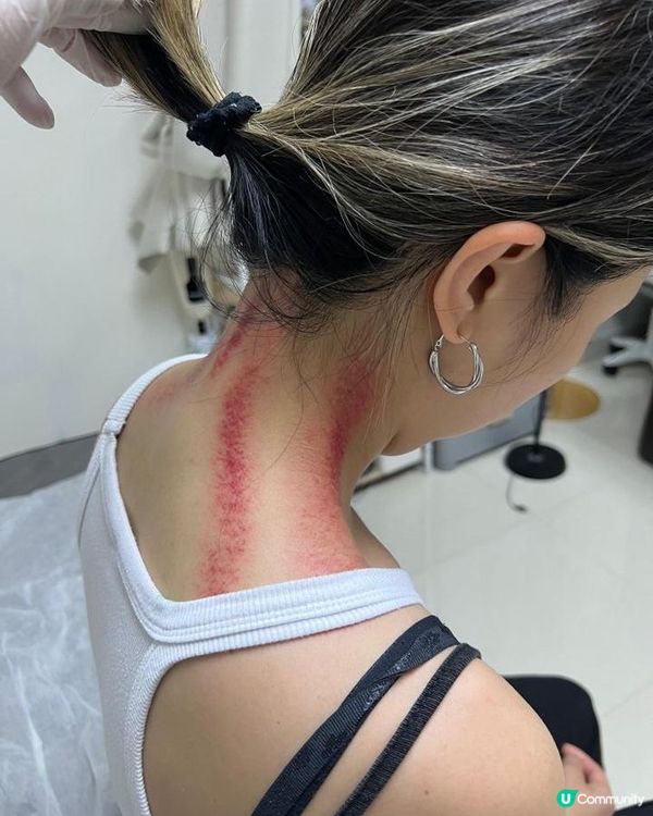 頸梗膊痛？觀塘痛症治療中心幫到你！💪🏻🤕