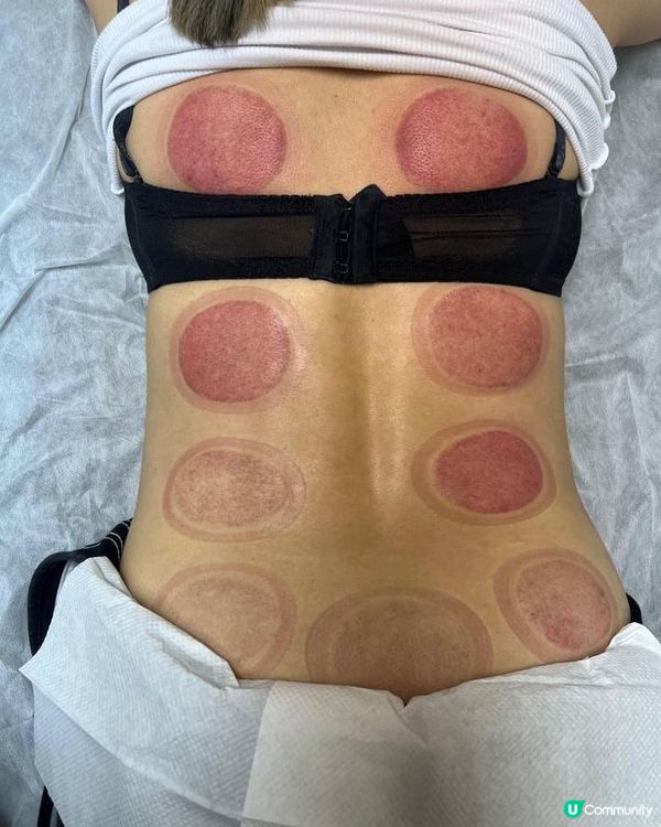 頸梗膊痛？觀塘痛症治療中心幫到你！💪🏻🤕