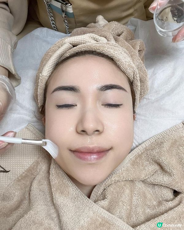 毛孔粗大仲有救嗎？親身實證有效改善黑頭粉刺嘅MSR拋光術