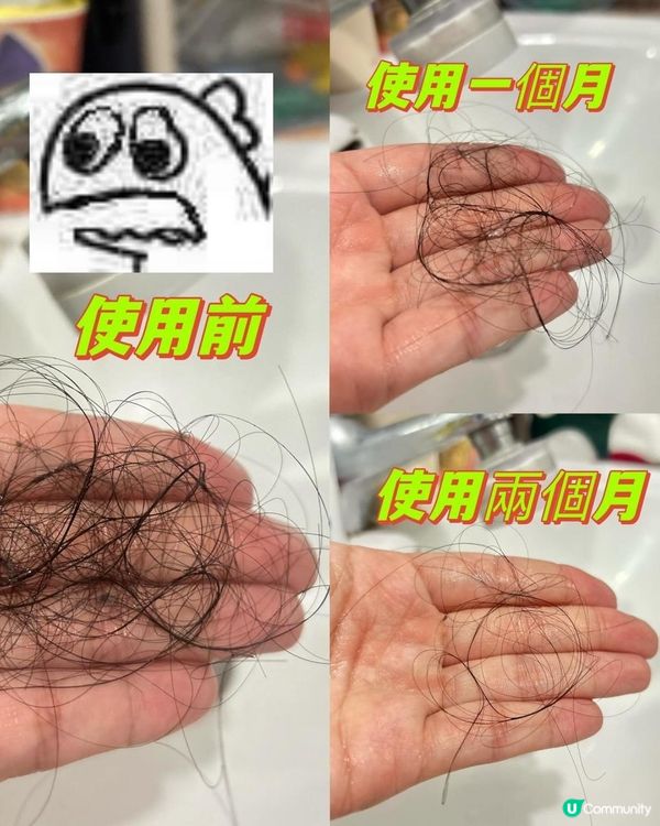 產後媽媽脫髮恩物