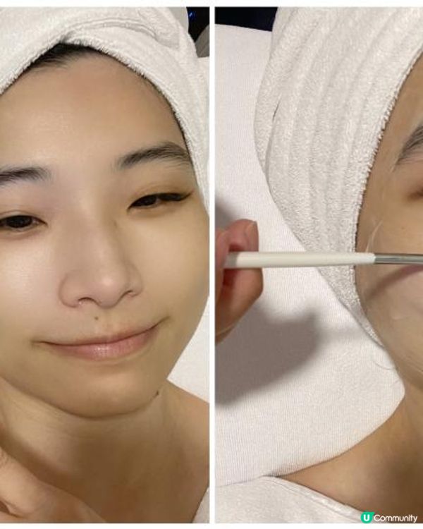 最新ConsGuard 星辰Glow Up療程