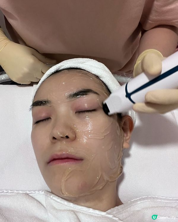 RF 膠原蛋白增生！星辰Glow up療程