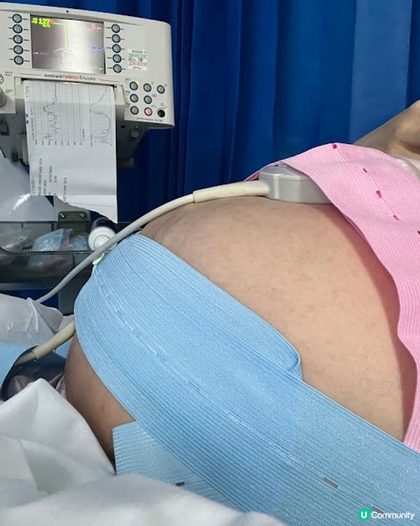 [英國懷孕記21/22] 16小時催生加順產 英國生產全紀錄