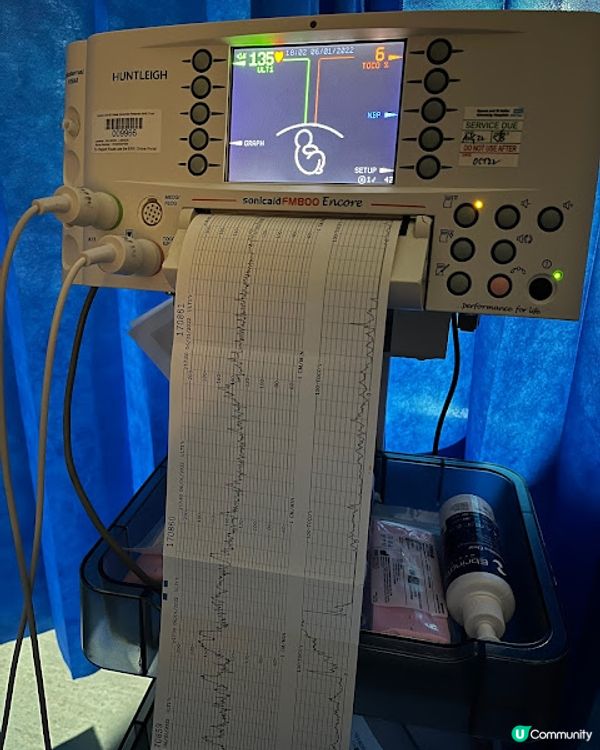 [英國懷孕記21/22] 16小時催生加順產 英國生產全紀錄