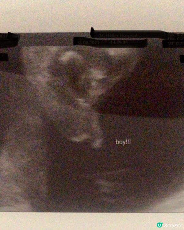 [英國懷孕記21/22] 孕中期的不安與衝擊 Week 13 - Week 26