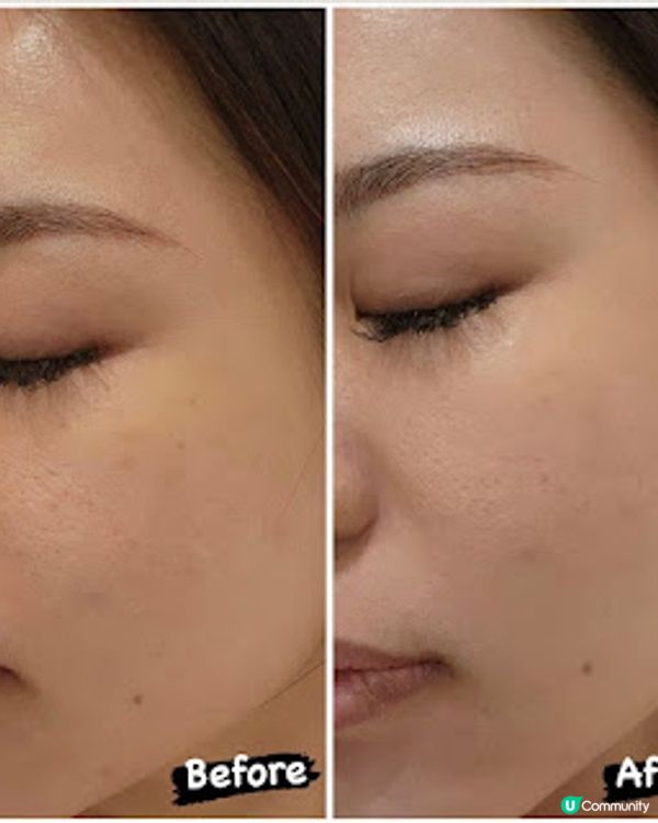 【享受Me Time】 1 Take過減雙下巴除頸紋 CLINICZ水原共生 高效瘦面之選！