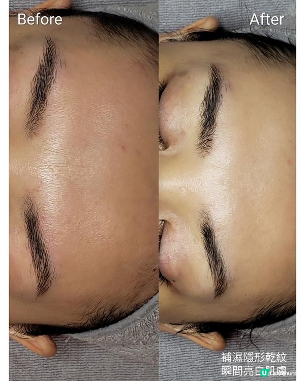 【nano Beauty】急救沙漠肌療程