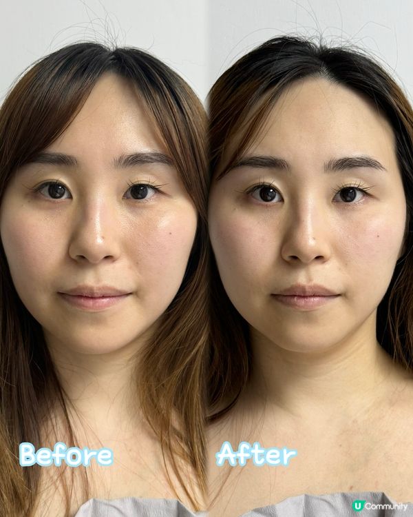 最近工作好攰 去咗旺角 AKA Beauty 美容院