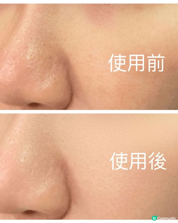 日日都咁曬，點可以唔搽防曬呢？