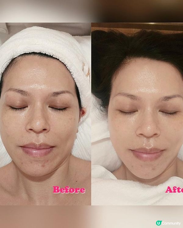 TONYBLACK全新皇牌逆齡護理療程