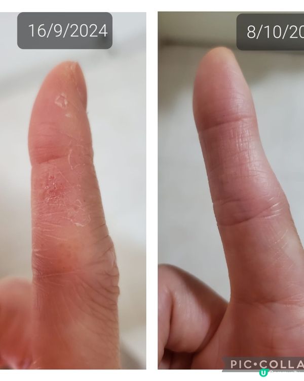 奇妙的修復效果❤️🤗