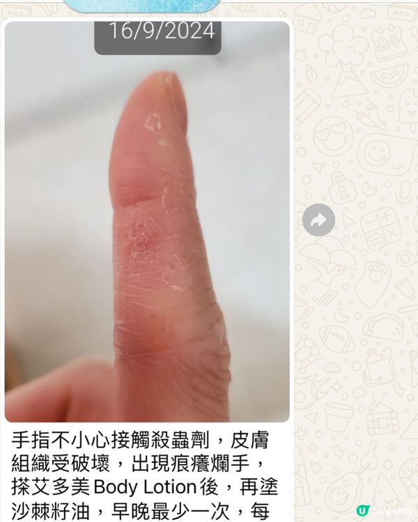 奇妙的修復效果❤️🤗