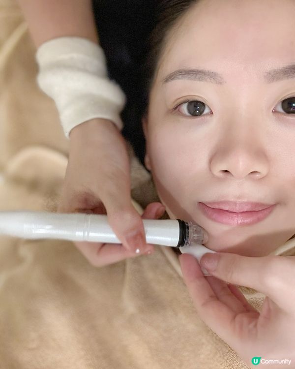 Skincure💦 女神針療程