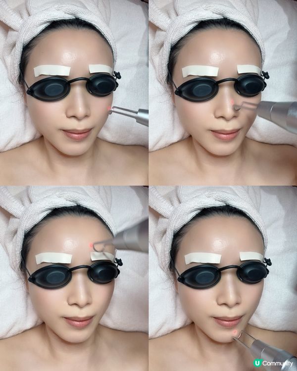 ## 🏃🏻‍♀️都市人必備！雙重皮秒去斑，快靚正！🤩