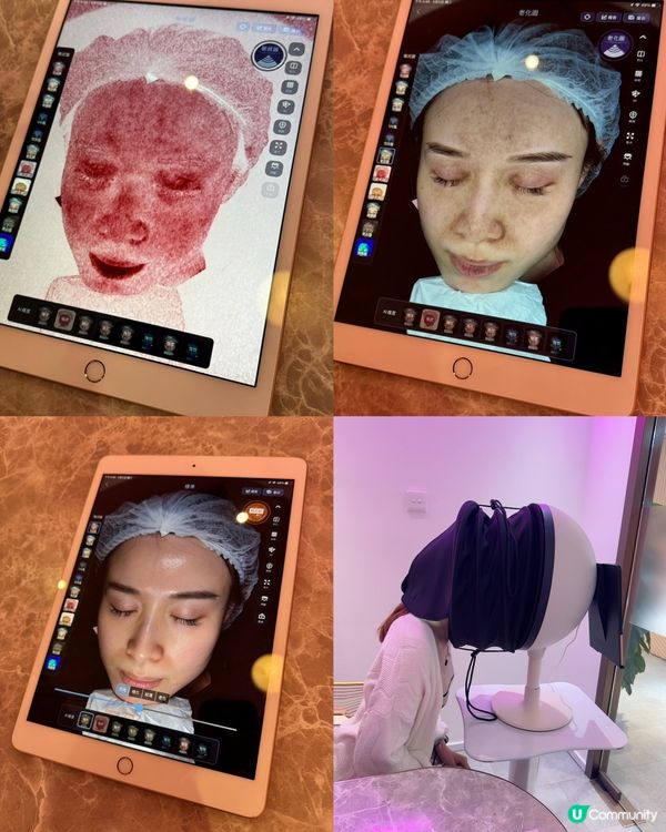 ## 🏃🏻‍♀️都市人必備！雙重皮秒去斑，快靚正！🤩