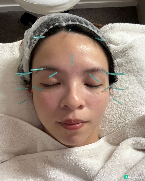 【InnerMe芍妍美｜中醫美容黑眼圈療程】