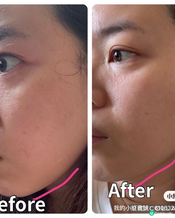 OlAY 我用得最多就一定係 美白 系列🙈