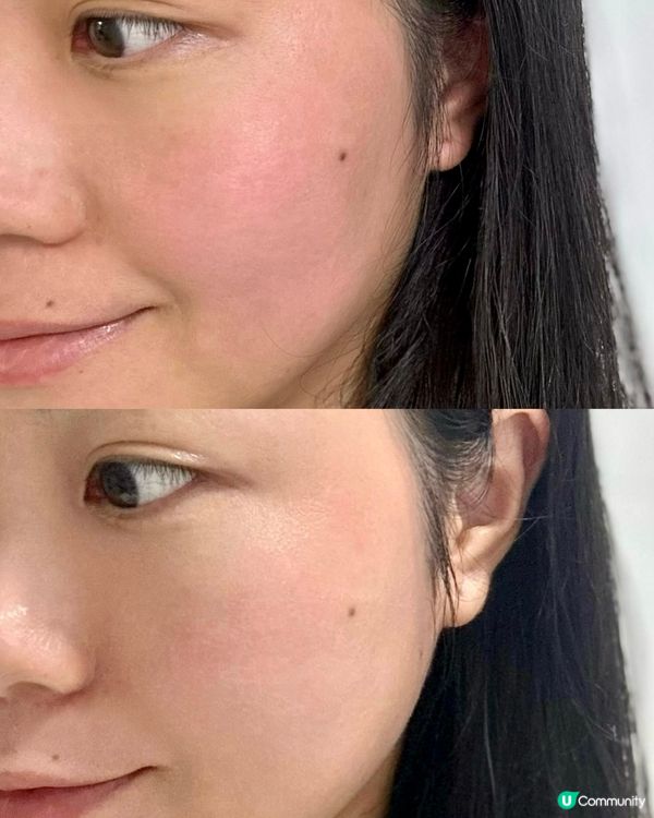  EMAY PLUS 殺痘小飛船紓緩轉季敏感必備