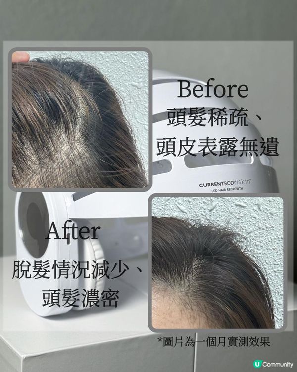 # 使用LED光療生髮帽的體驗分享