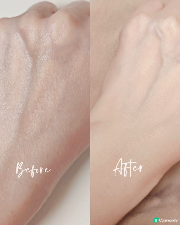 本身係敏感肌好易痕癢又出粒粒,特別係轉季時候就更加要留神!之...